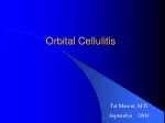 PPT - Orbital Cellulitis PowerPoint Presentation, free download - ID ...