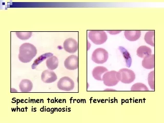 Specimen taken from feverish patient what is diagnosis