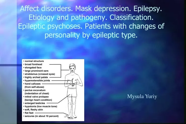 affect disorders mask depression epilepsy