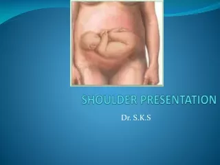 SHOULDER PRESENTATION