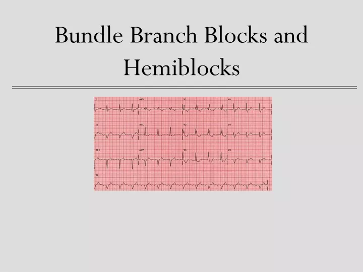 bundle branch blocks and hemiblocks