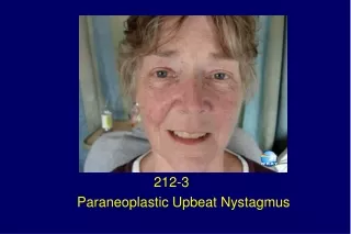212-3 Paraneoplastic Upbeat Nystagmus