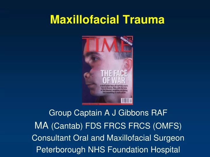 maxillofacial trauma