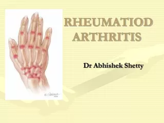 RHEUMATIOD ARTHRITIS