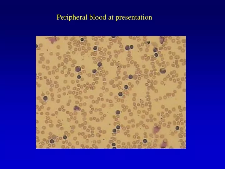 peripheral blood at presentation
