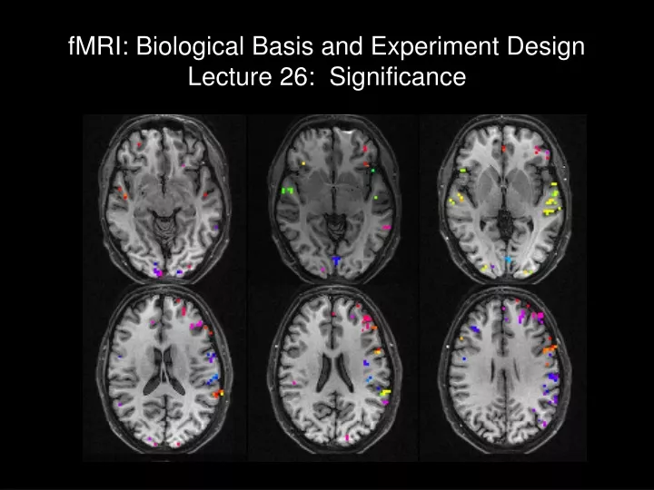 fmri biological basis and experiment design lecture 26 significance