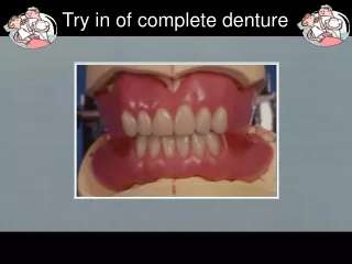 Try in of complete denture