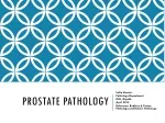 PPT - Pathology Of Prostate - Cancer PowerPoint Presentation, Free ...