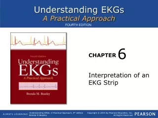 Interpretation of an EKG Strip