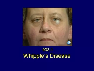 Whipple’s Disease