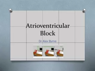 Atrioventricular Block