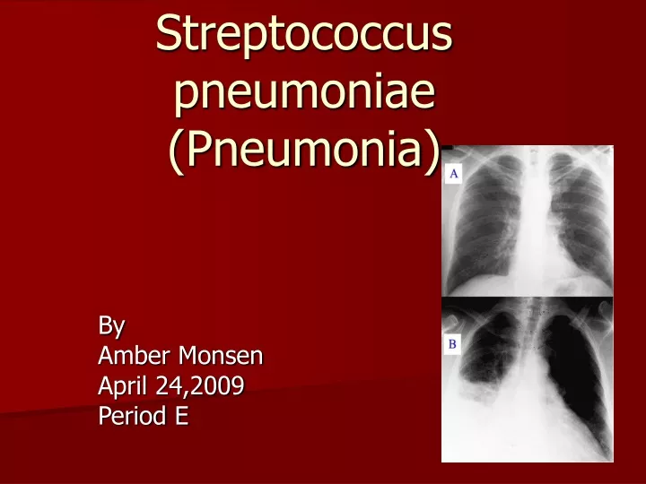 streptococcus pneumoniae pneumonia