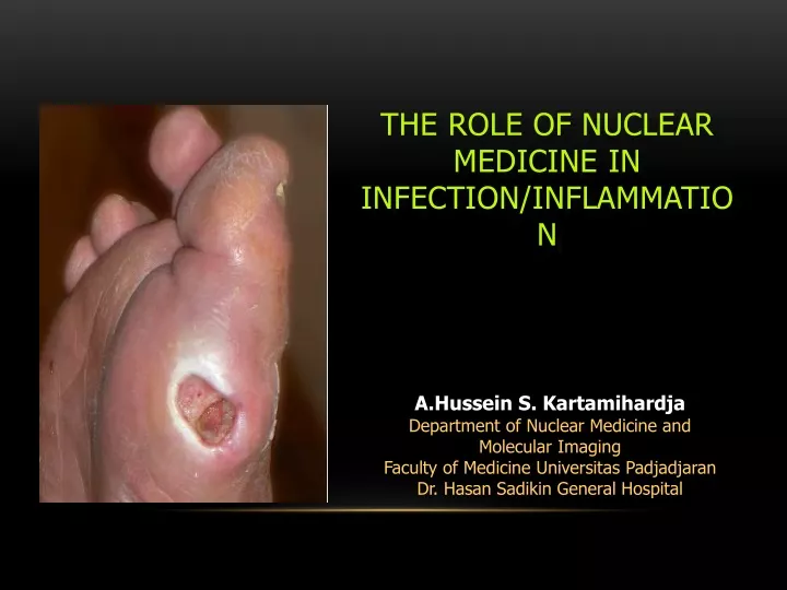the role of nuclear medicine in infection inflammation