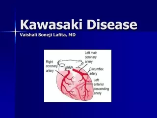 Kawasaki Disease Vaishali Soneji Lafita, MD