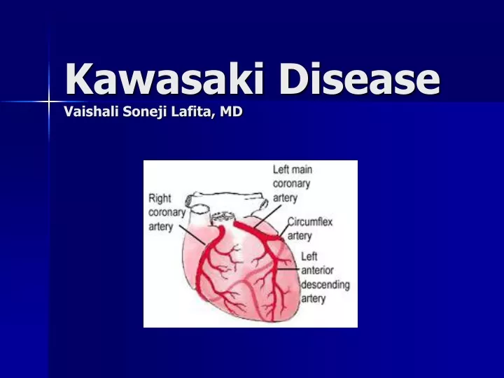 kawasaki disease vaishali soneji lafita md