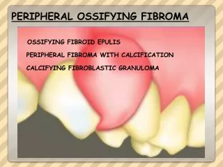 PERIPHERAL OSSIFYING FIBROMA