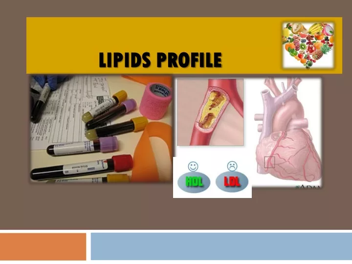 lipids profile