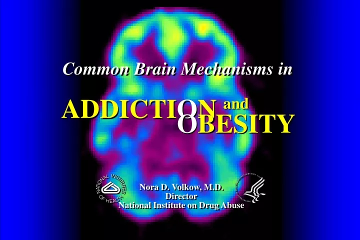 common brain mechanisms in addicti o n