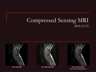 Compressed Sensing MRI 2016.12.15