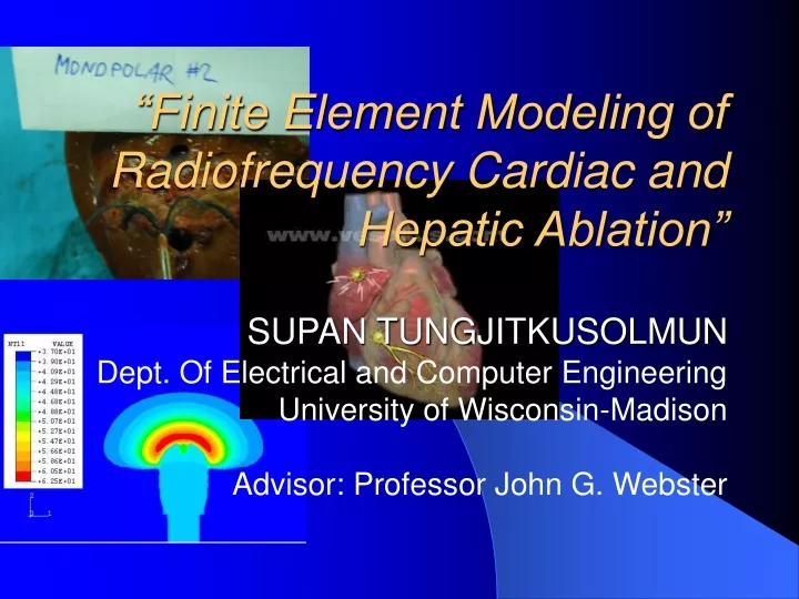 finite element modeling of radiofrequency cardiac