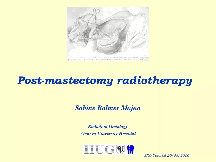 post mastectomy radiotherapy