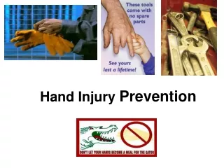 Hand Injury  Prevention