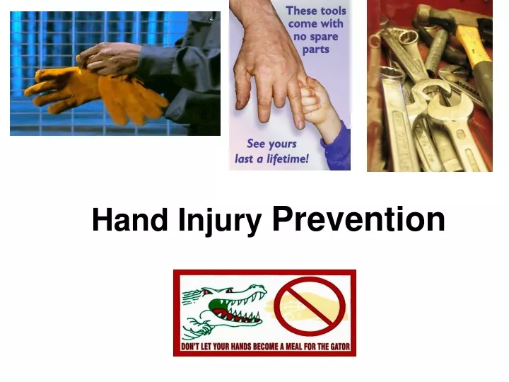 hand injury prevention