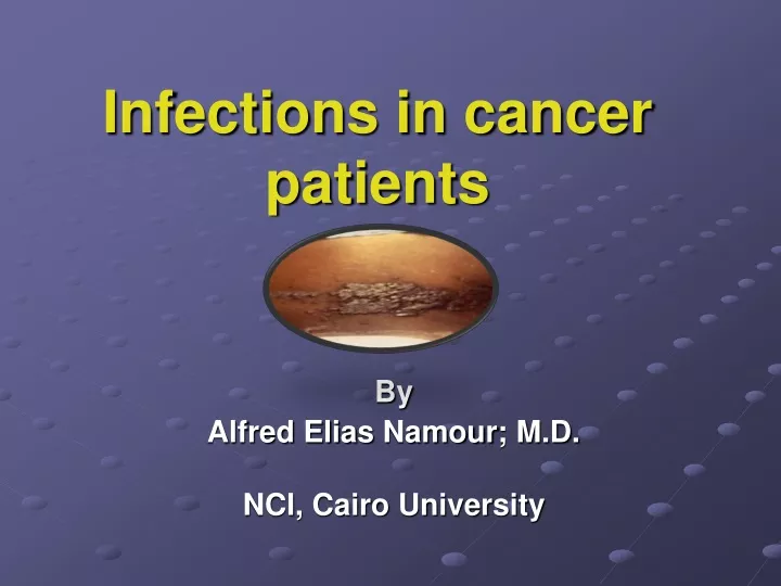 infections in cancer patients