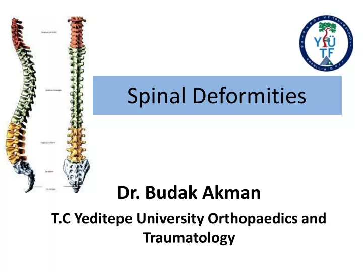spinal deformities