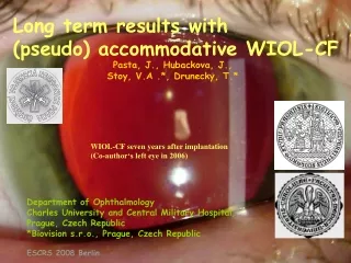 Long term results with         (pseudo) accommodative WIOL-CF