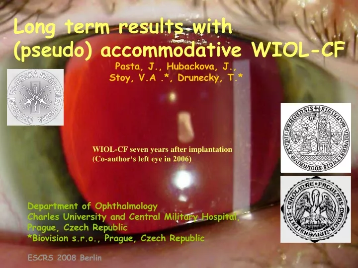 long term results with pseudo accommodative wiol cf