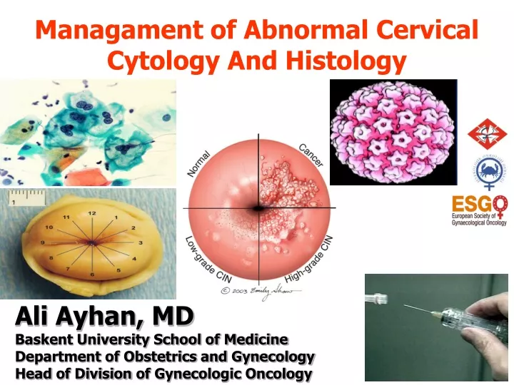 managament of abnormal cervical cytology
