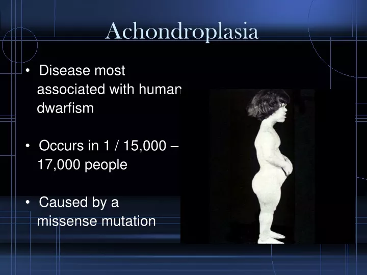 achondroplasia