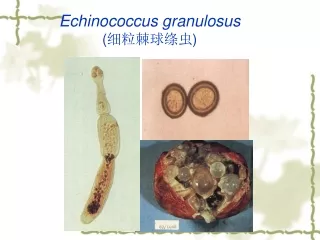 Echinococcus granulosus ( 细粒棘球绦虫 )