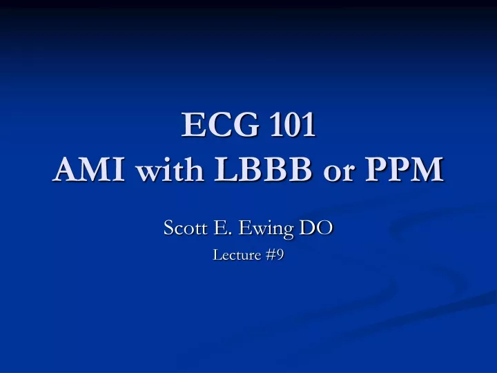 ecg 101 ami with lbbb or ppm
