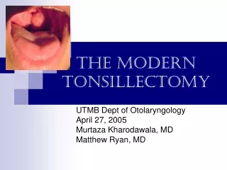 The Modern Tonsillectomy