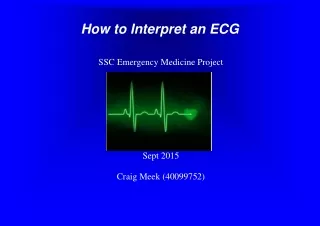 How to Interpret an ECG