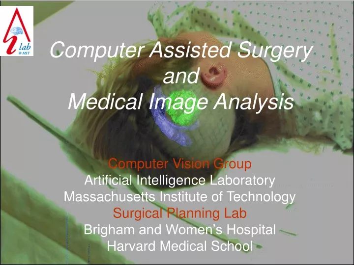 computer assisted surgery and medical image analysis