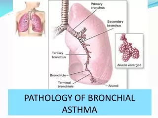PATHOLOGY OF BRONCHIAL ASTHMA