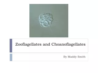 Zooflagellates and Choanoflagellates