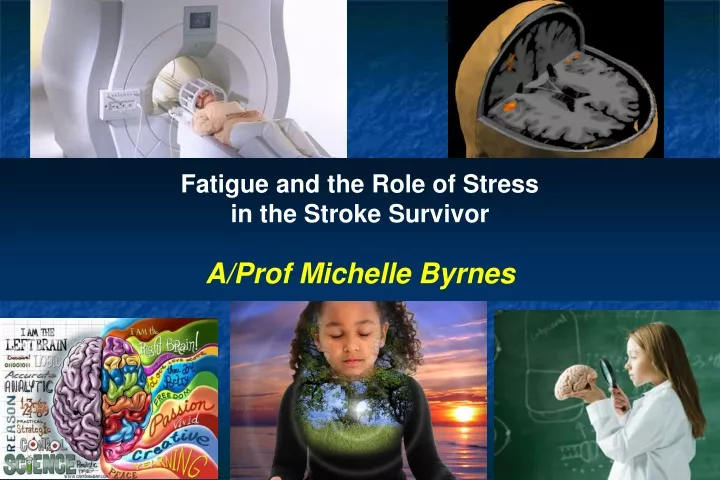 fatigue and the role of stress in the stroke