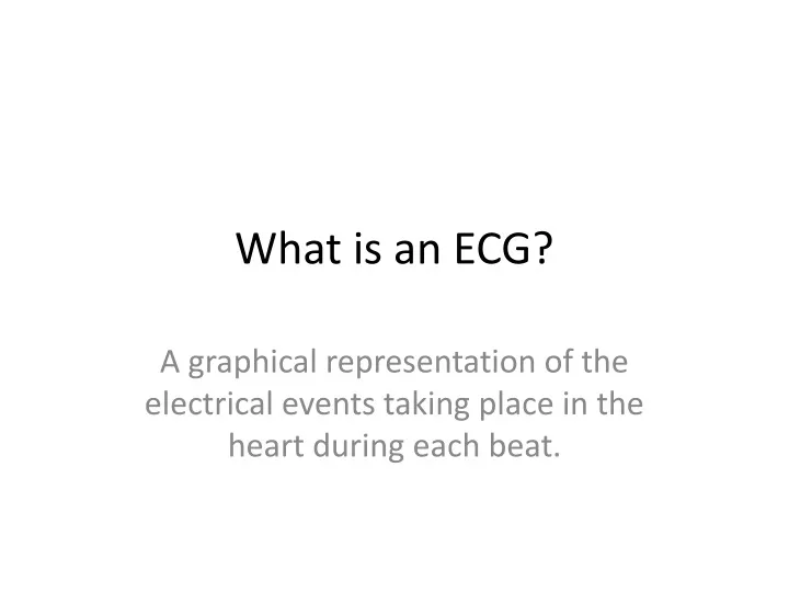 what is an ecg
