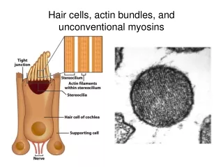 Hair cells, actin bundles, and unconventional myosins