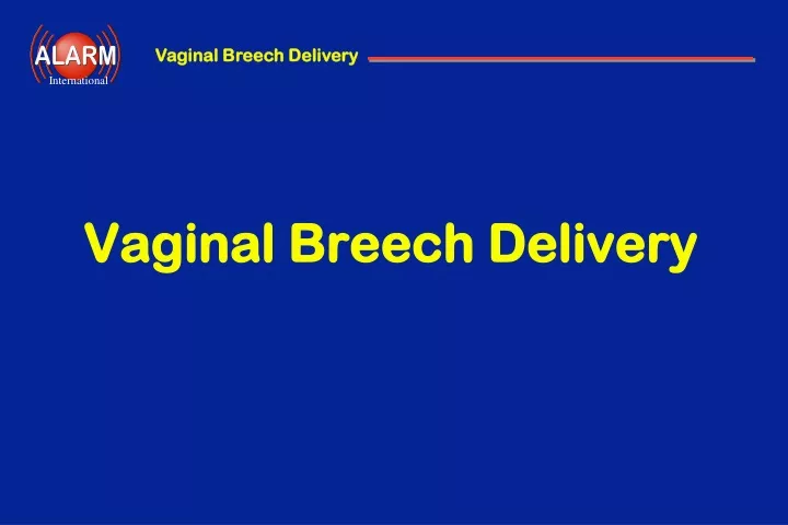 vaginal breech delivery