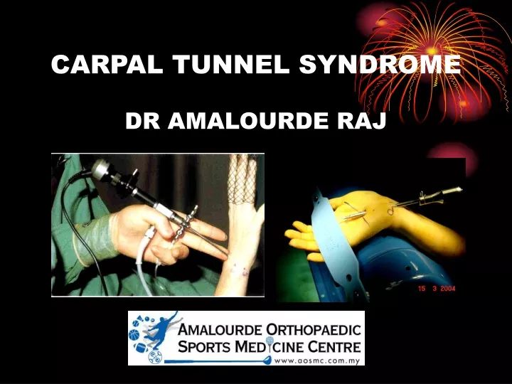 carpal tunnel syndrome dr amalourde raj