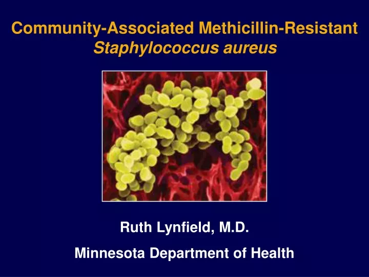 community associated methicillin resistant staphylococcus aureus