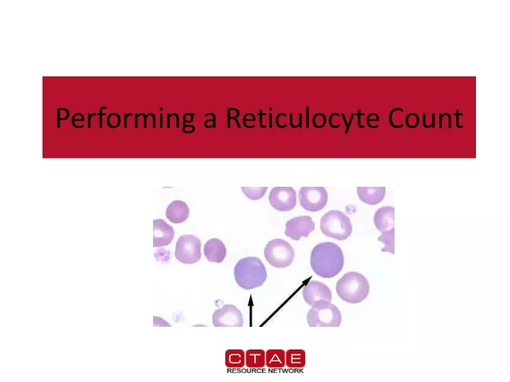 performing a reticulocyte count