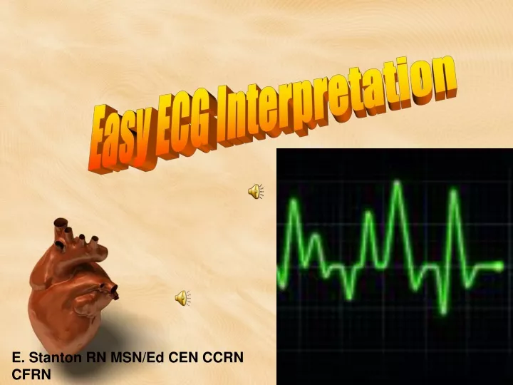 easy ecg interpretation