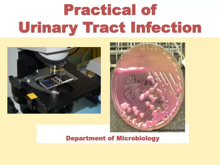 practical of urinary tract infection