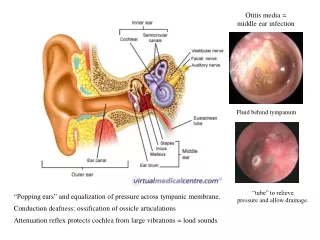 Conduction deafness: ossification of ossicle articulations